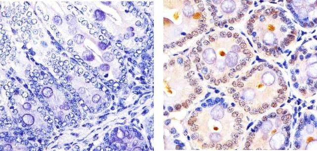 Cullin 2 Antibody in Immunohistochemistry (Paraffin) (IHC (P))