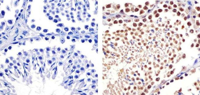 Cullin 2 Antibody in Immunohistochemistry (Paraffin) (IHC (P))