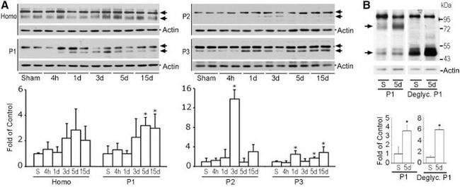 LAMP-2A Antibody in Western Blot (WB)