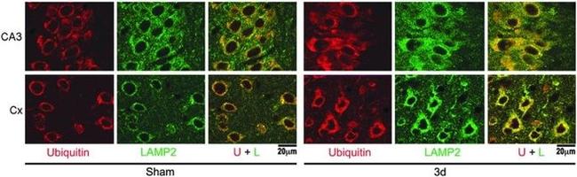 LAMP-2A Antibody in Immunohistochemistry (IHC)