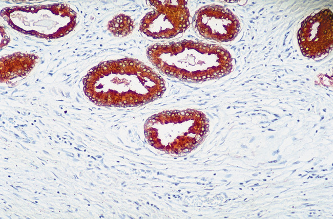 PTEN Antibody in Immunohistochemistry (IHC)