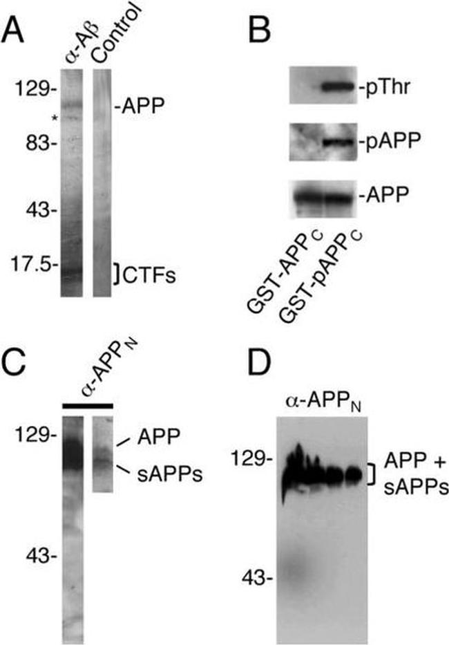 beta Amyloid Antibody in Western Blot (WB)