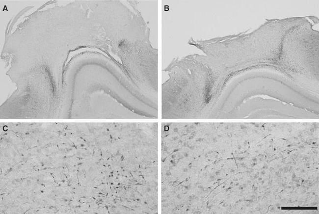 beta Amyloid Antibody in Immunohistochemistry - Free Floating (IHC (Free))