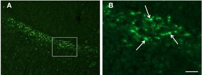 beta Amyloid Antibody in Immunohistochemistry (IHC)