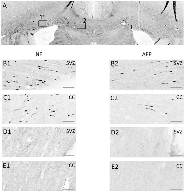 beta Amyloid Antibody in Immunohistochemistry (IHC)