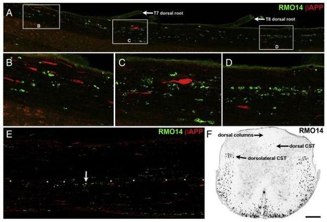 beta Amyloid Antibody in Immunohistochemistry (IHC)