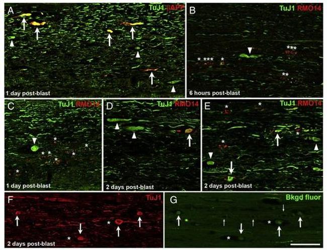 beta Amyloid Antibody in Immunohistochemistry (IHC)