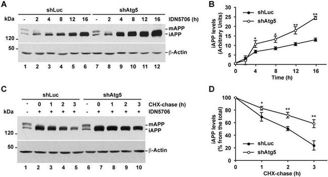 beta Amyloid Antibody in Western Blot (WB)