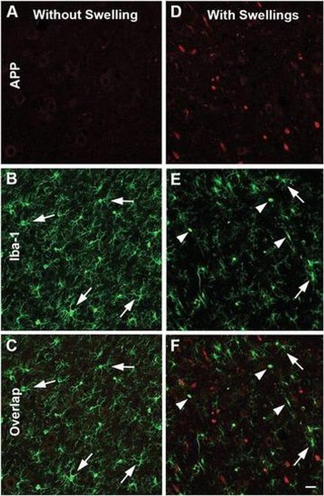 beta Amyloid Antibody in Immunohistochemistry (IHC)