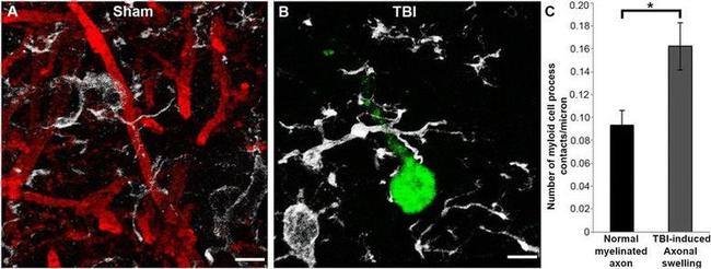 beta Amyloid Antibody in Immunohistochemistry (IHC)