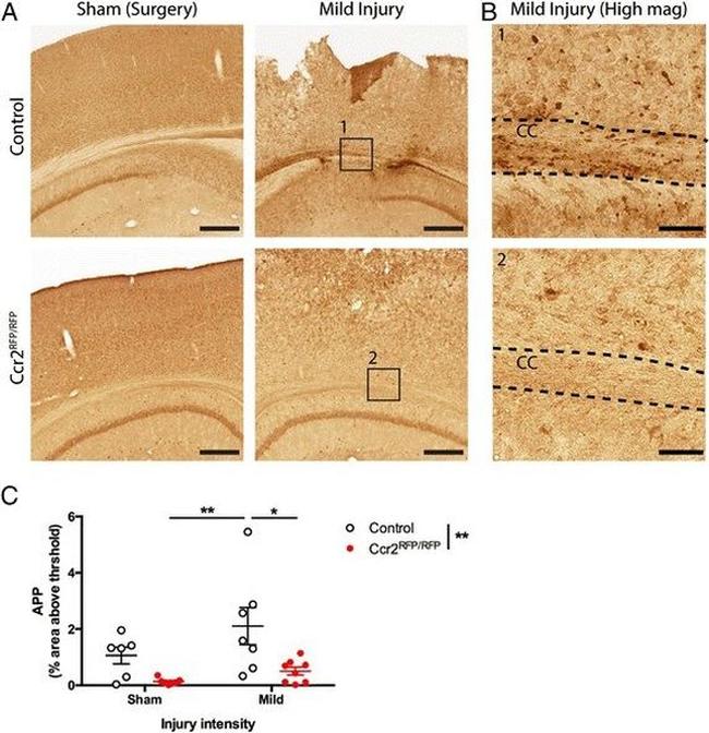 beta Amyloid Antibody in Immunohistochemistry (IHC)