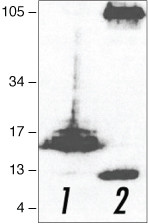 beta Amyloid Antibody in Western Blot (WB)