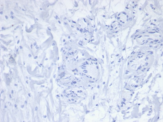 PDCD1/PD1/CD279 (Programmed Cell Death 1) Antibody in Immunohistochemistry (Paraffin) (IHC (P))