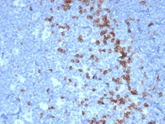 PDCD1/PD1/CD279 (Programmed Cell Death 1) Antibody in Immunohistochemistry (Paraffin) (IHC (P))