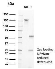 PDCD1/PD1/CD279 (Programmed Cell Death 1) Antibody in SDS-PAGE (SDS-PAGE)