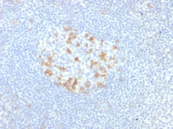 PDCD1/PD1/CD279 (Programmed Cell Death 1) Antibody in Immunohistochemistry (Paraffin) (IHC (P))
