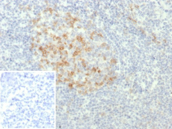 PDCD1/PD1/CD279 (Programmed Cell Death 1) Antibody in Immunohistochemistry (Paraffin) (IHC (P))