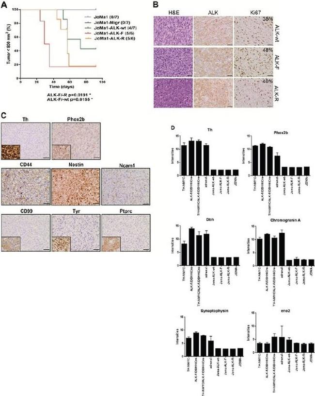 ALK Antibody in Immunohistochemistry (IHC)