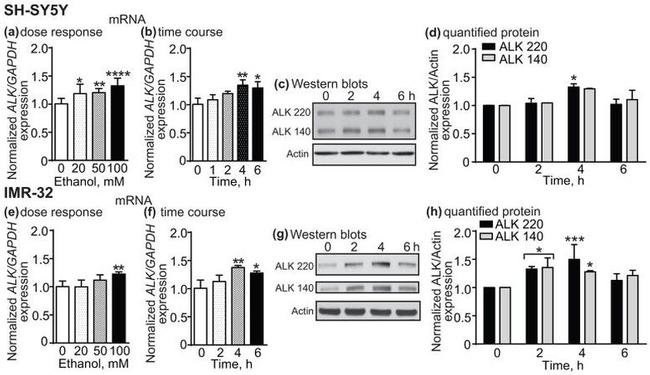 ALK Antibody in Western Blot (WB)