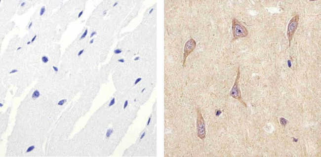 ALK Antibody in Immunohistochemistry (Paraffin) (IHC (P))