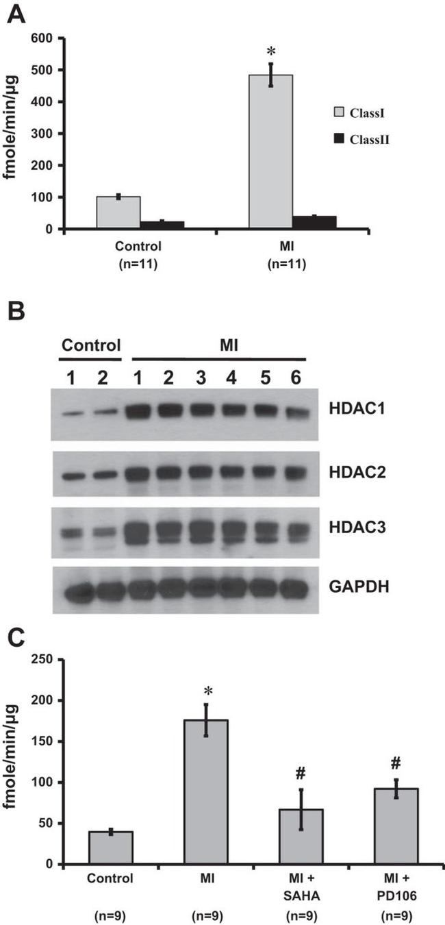 HDAC2 Antibody in Western Blot (WB)