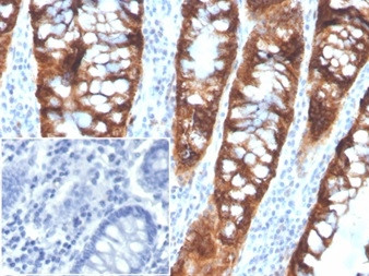 PDGF beta (PDGFB) Antibody in Immunohistochemistry (Paraffin) (IHC (P))