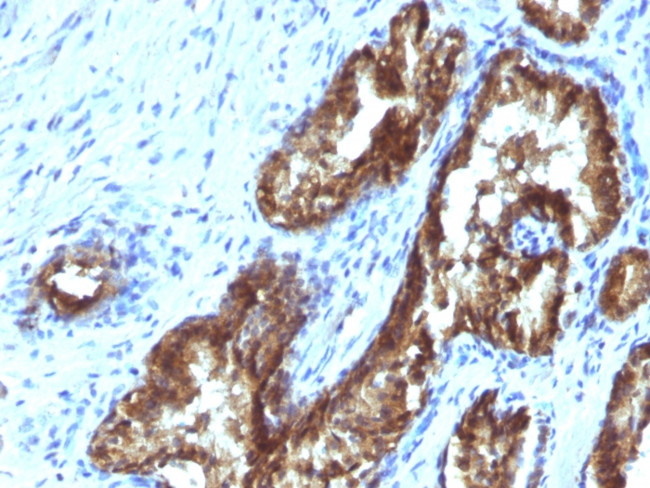 TDP2/EAPII Antibody in Immunohistochemistry (Paraffin) (IHC (P))