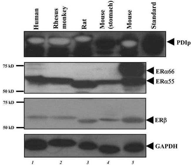 Estrogen Receptor beta Antibody in Western Blot (WB)