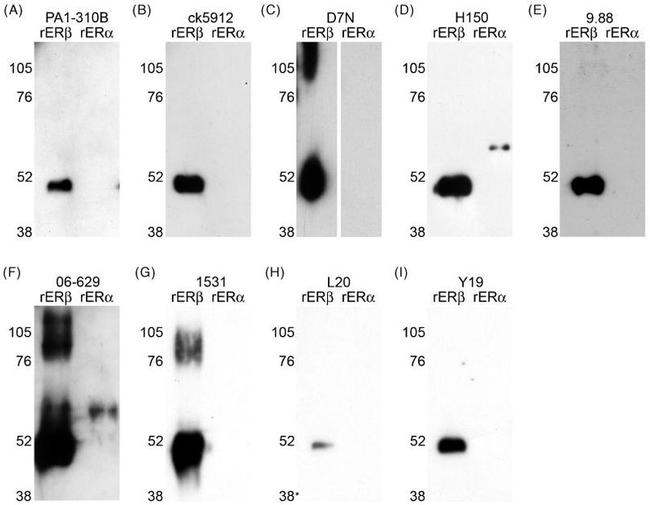 Estrogen Receptor beta Antibody in Western Blot (WB)