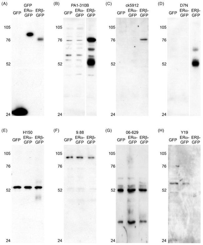 Estrogen Receptor beta Antibody in Western Blot (WB)