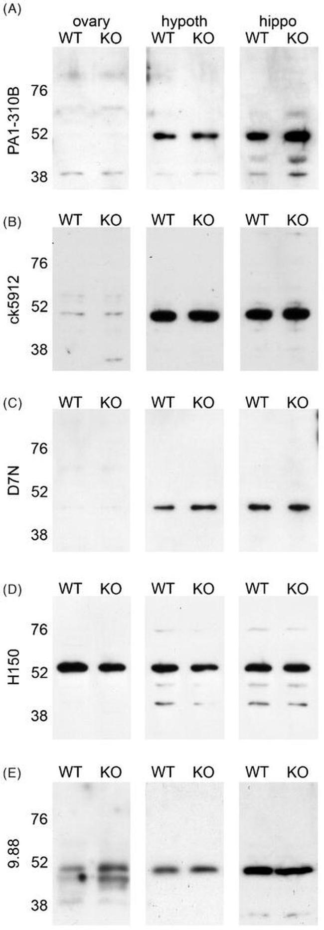 Estrogen Receptor beta Antibody in Western Blot (WB)