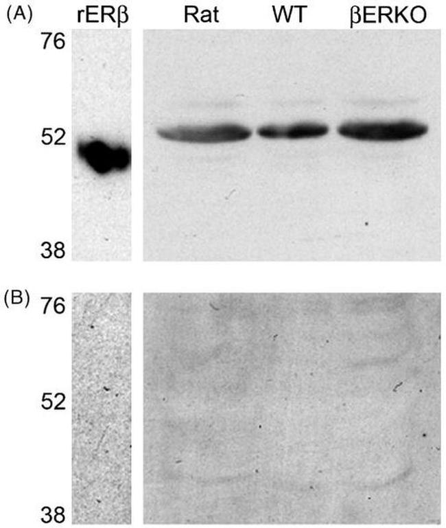 Estrogen Receptor beta Antibody in Western Blot (WB)