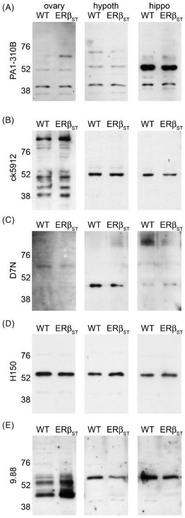 Estrogen Receptor beta Antibody in Western Blot (WB)