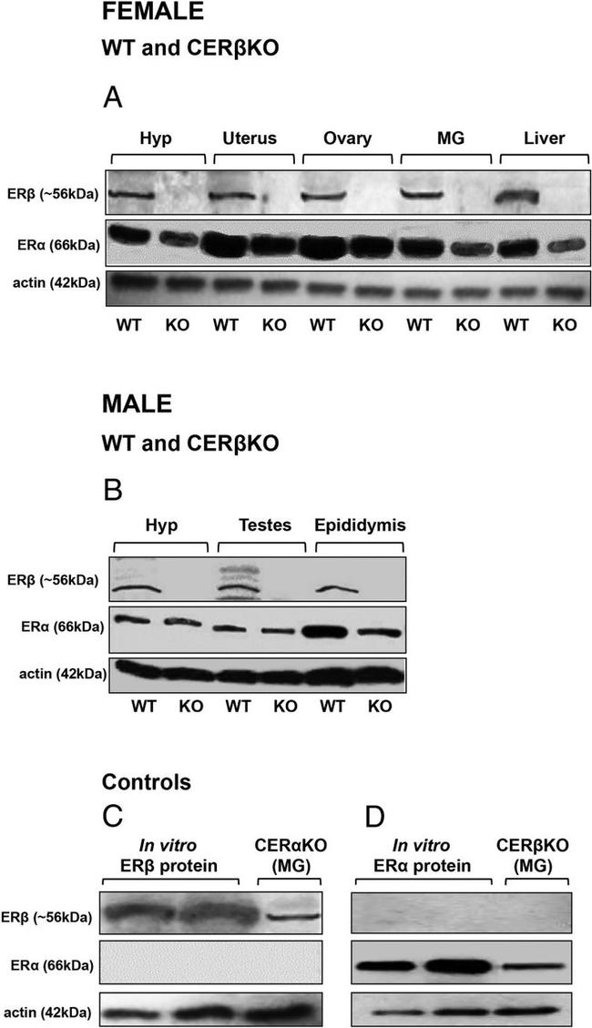 Estrogen Receptor beta Antibody in Western Blot (WB)