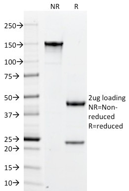 PLGF (Placental Growth Factor) Antibody in SDS-PAGE (SDS-PAGE)