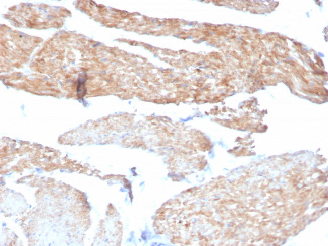 Aciculin/Phosphoglucomutase 5 (PGM5) Antibody in Immunohistochemistry (Paraffin) (IHC (P))