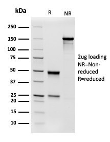 Aciculin/Phosphoglucomutase 5 (PGM5) Antibody in SDS-PAGE (SDS-PAGE)