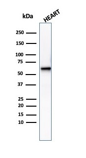 Aciculin/Phosphoglucomutase 5 (PGM5) Antibody in Western Blot (WB)