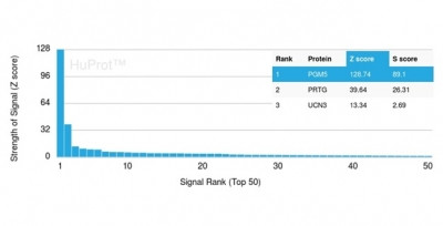 Aciculin/Phosphoglucomutase 5 (PGM5) Antibody in Peptide array (ARRAY)