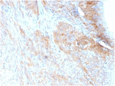 Aciculin/Phosphoglucomutase 5 (PGM5) Antibody in Immunohistochemistry (Paraffin) (IHC (P))