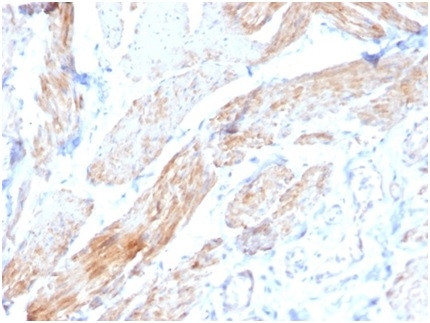 Aciculin/Phosphoglucomutase 5 (PGM5) Antibody in Immunohistochemistry (Paraffin) (IHC (P))