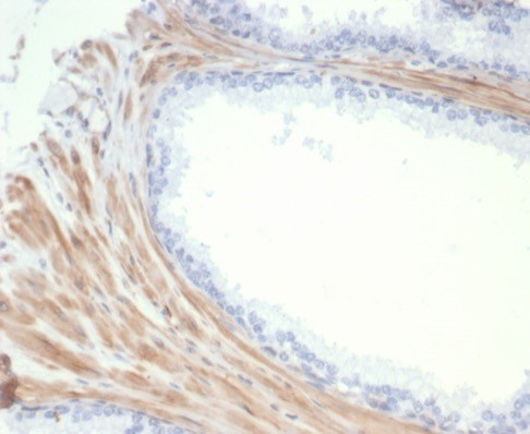 Aciculin/Phosphoglucomutase 5 (PGM5) Antibody in Immunohistochemistry (Paraffin) (IHC (P))