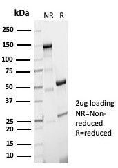 Aciculin/Phosphoglucomutase 5 (PGM5) Antibody in SDS-PAGE (SDS-PAGE)