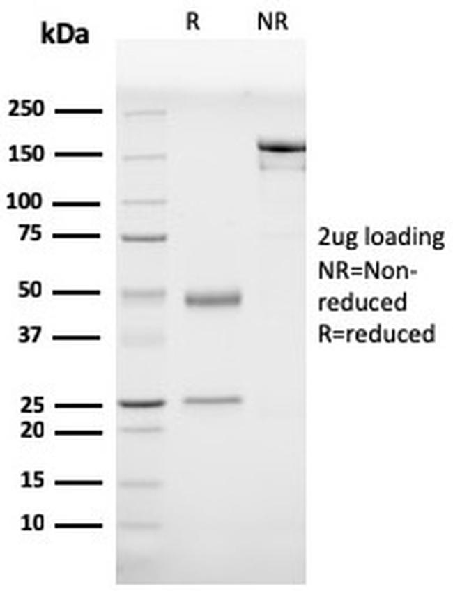Prohibitin Antibody in SDS-PAGE (SDS-PAGE)