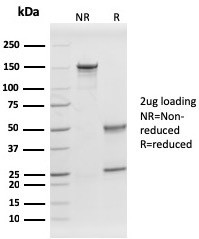 Prohibitin (Mitochondrial Marker) Antibody in SDS-PAGE (SDS-PAGE)