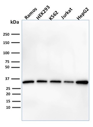 Prohibitin (Mitochondrial Marker) Antibody in Western Blot (WB)