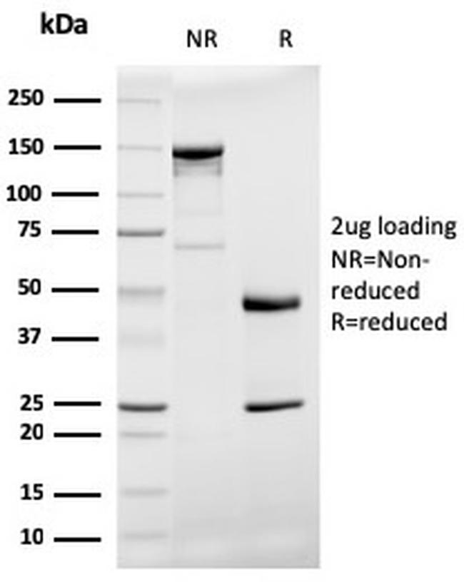 Prohibitin Antibody in SDS-PAGE (SDS-PAGE)