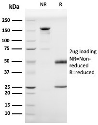 Prohibitin (Mitochondrial Marker) Antibody in SDS-PAGE (SDS-PAGE)