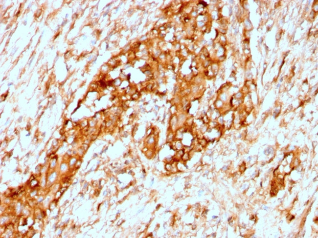 Alpha-1-Antitrypsin (SERPINA1) Antibody in Immunohistochemistry (Paraffin) (IHC (P))