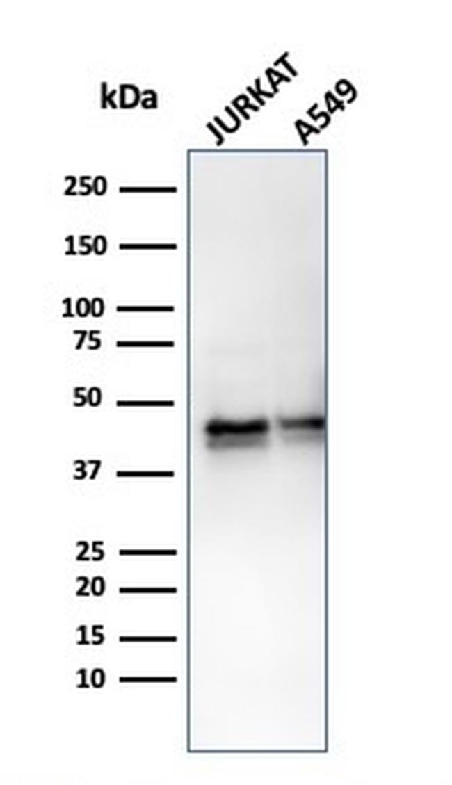 Alpha-1-Antitrypsin (SERPINA1) Antibody in Western Blot (WB)